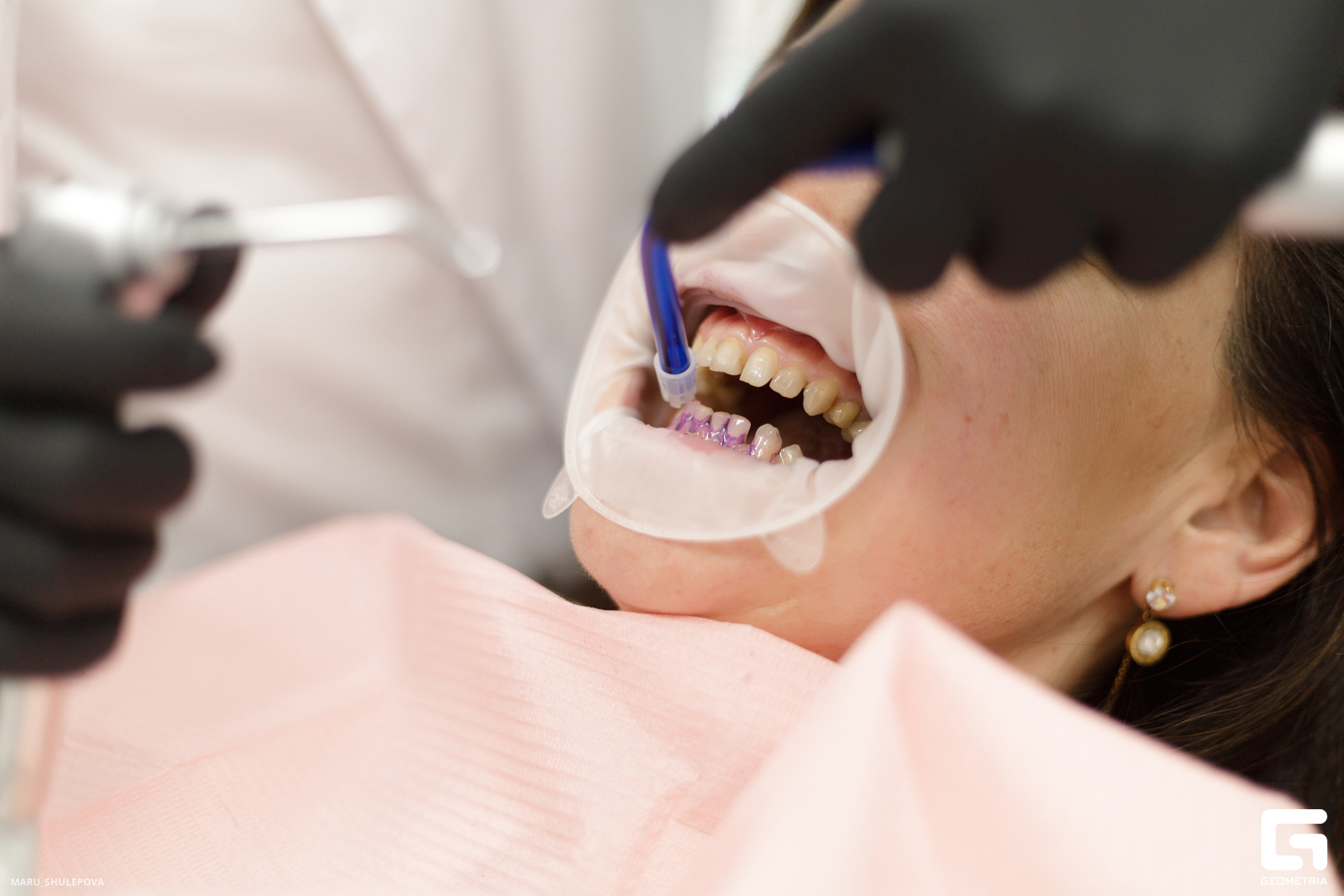 стоматолог-170.jpg
